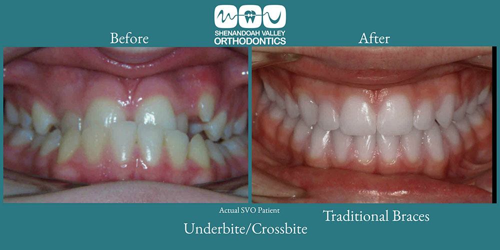 before and after image