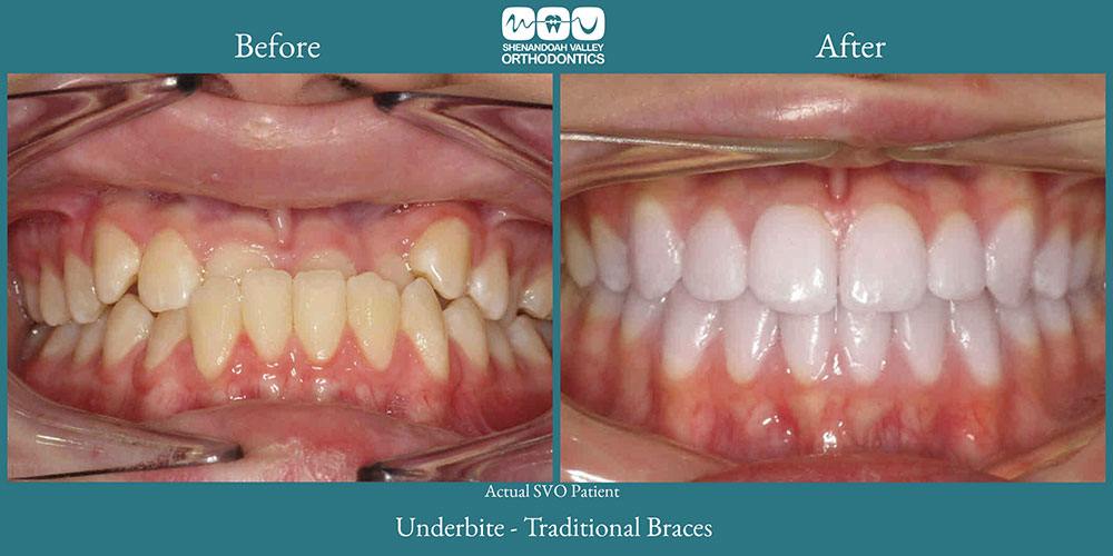 before and after image