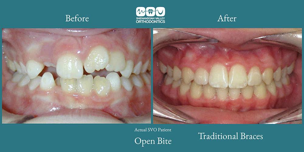 before and after image