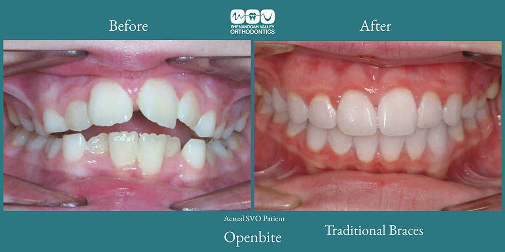 before and after image