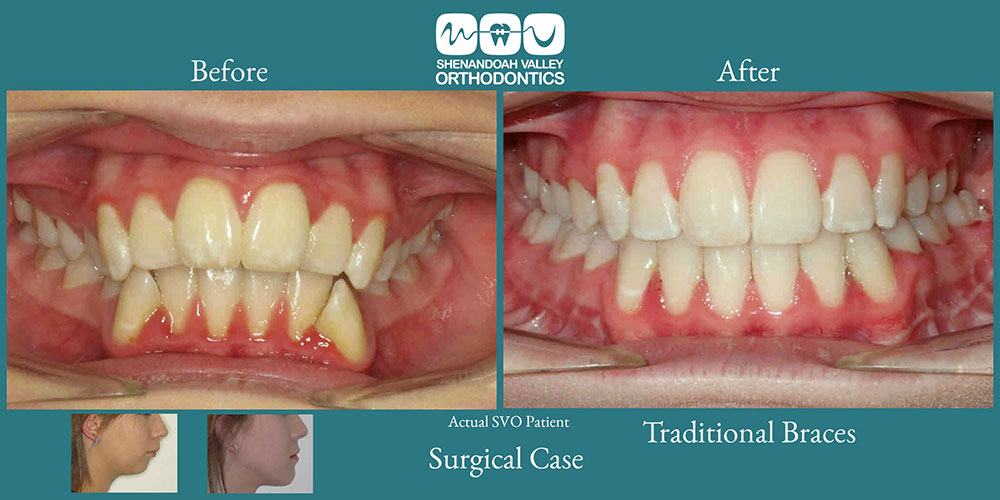 before and after image