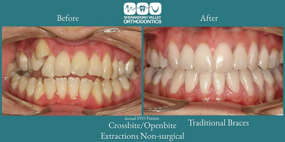 before and after image