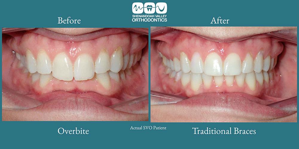 before and after image