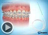 flossing video